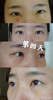 现在还有没有传奇世界私服